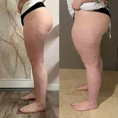 Mª Ángeles Ruiz, 47