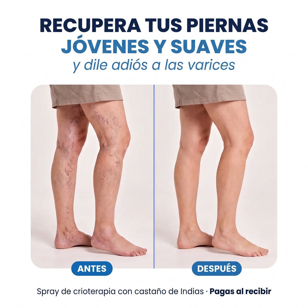 Antes y después: piernas jóvenes y suaves sin varices