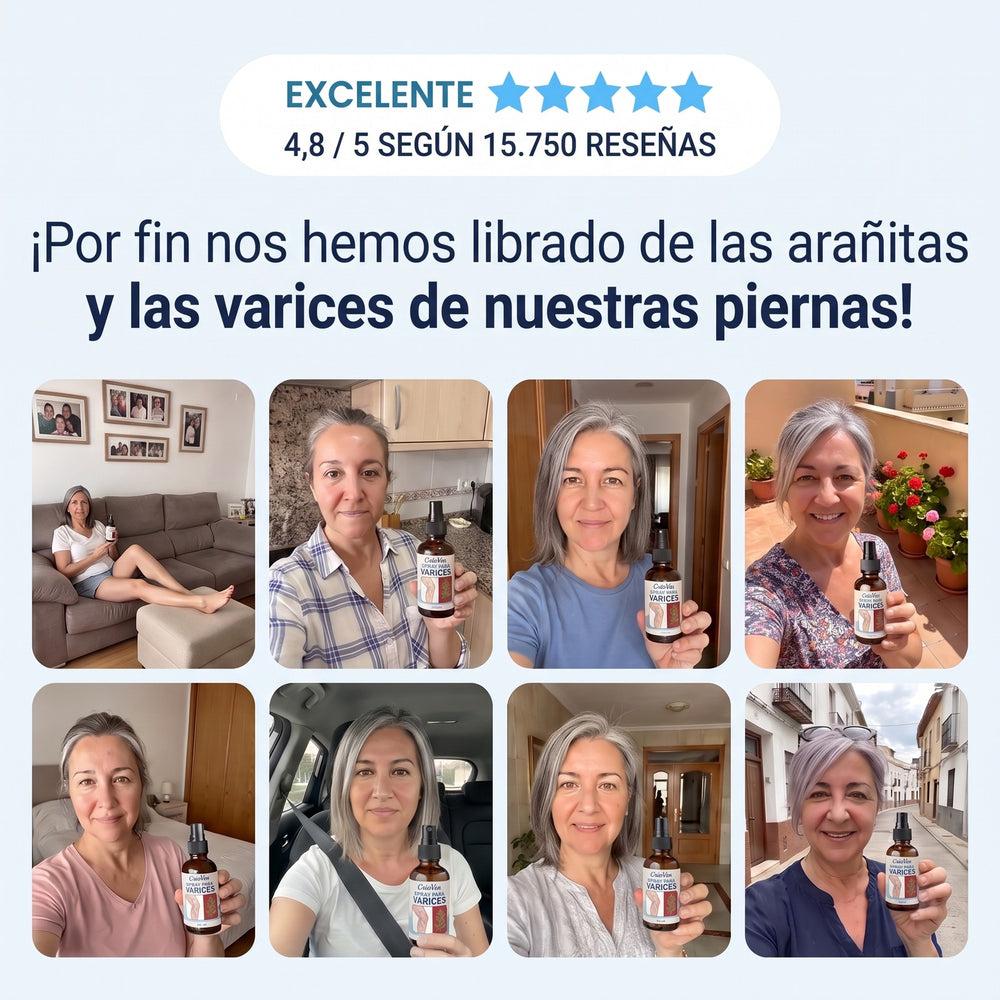 Clientas con el spray CrioVen: por fin sin arañitas ni varices