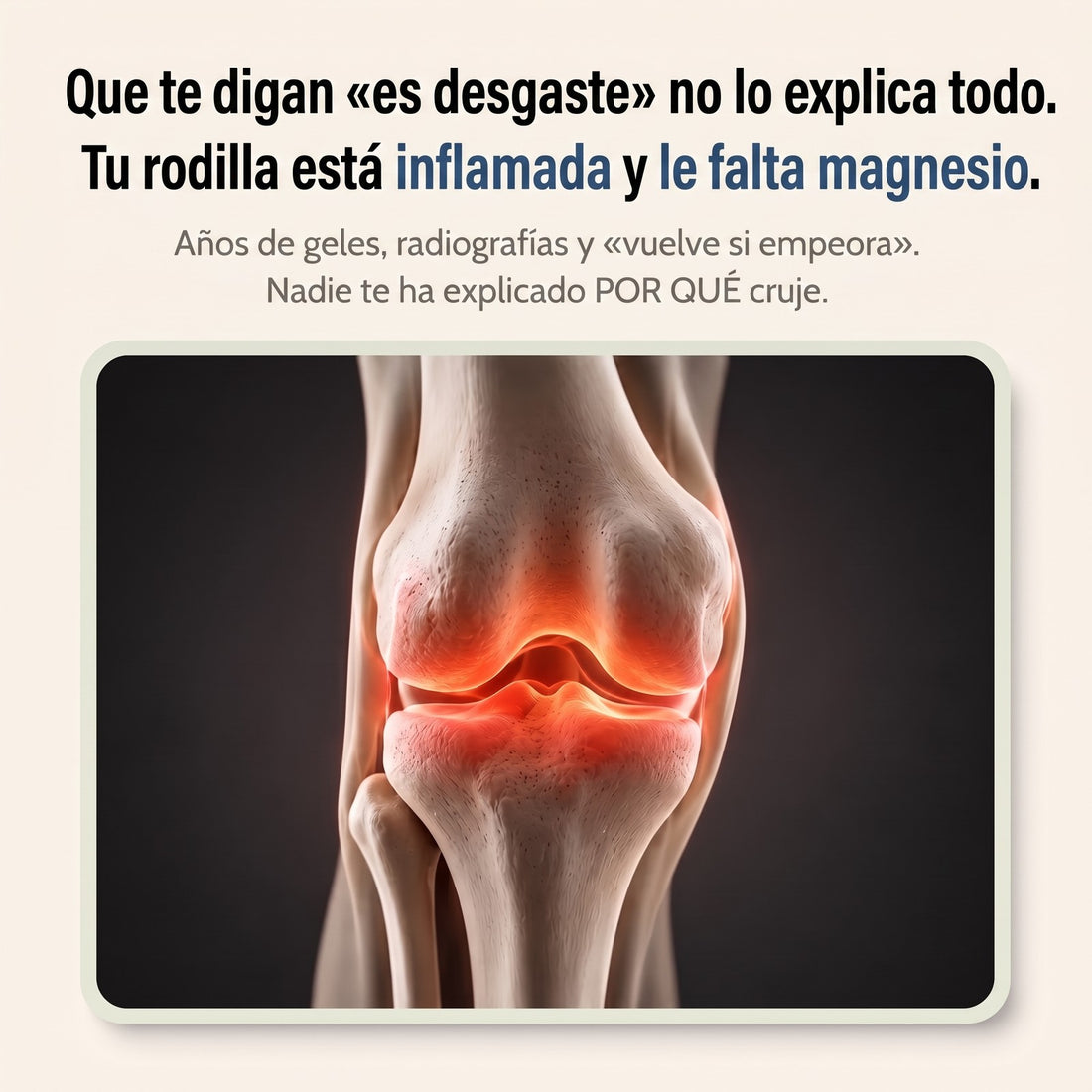 Que te digan «es desgaste» no lo explica todo: tu rodilla está inflamada y le falta magnesio