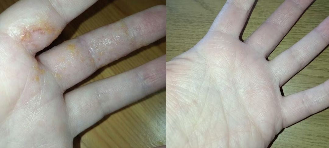 Antes y después · Ana J.