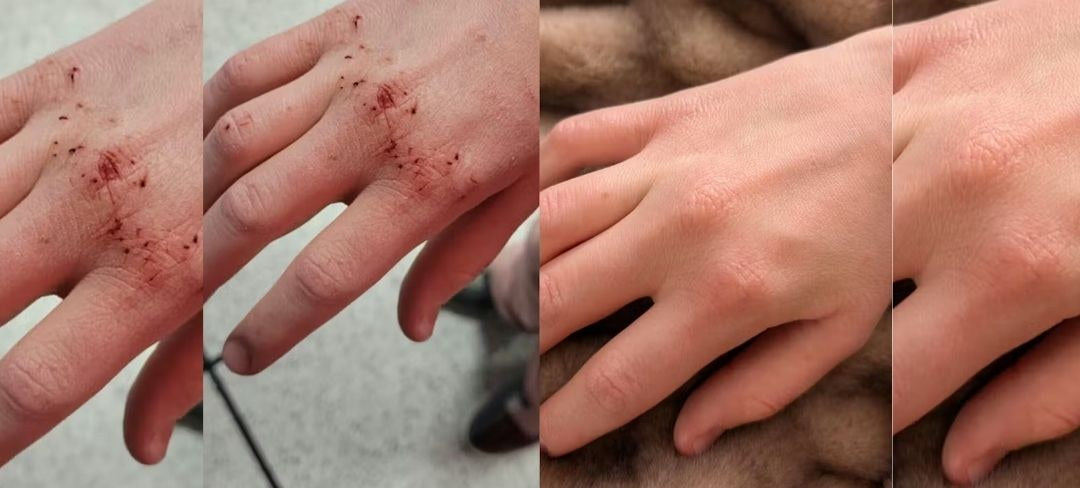 Antes y después · Beatriz M.