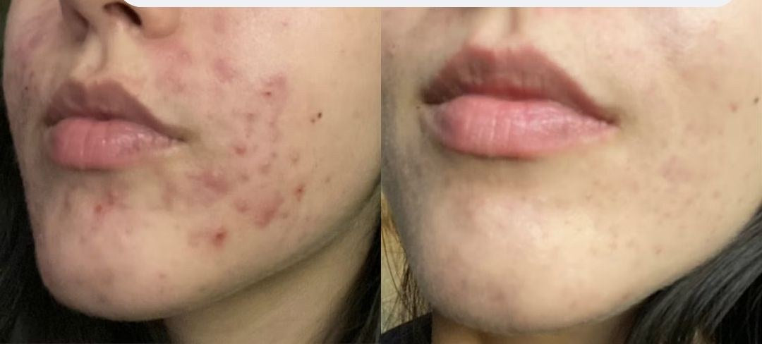 Antes y después · Alejandra B.