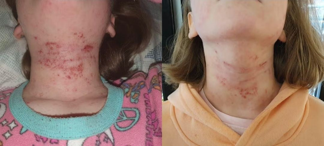 Antes y después · Rosa M.