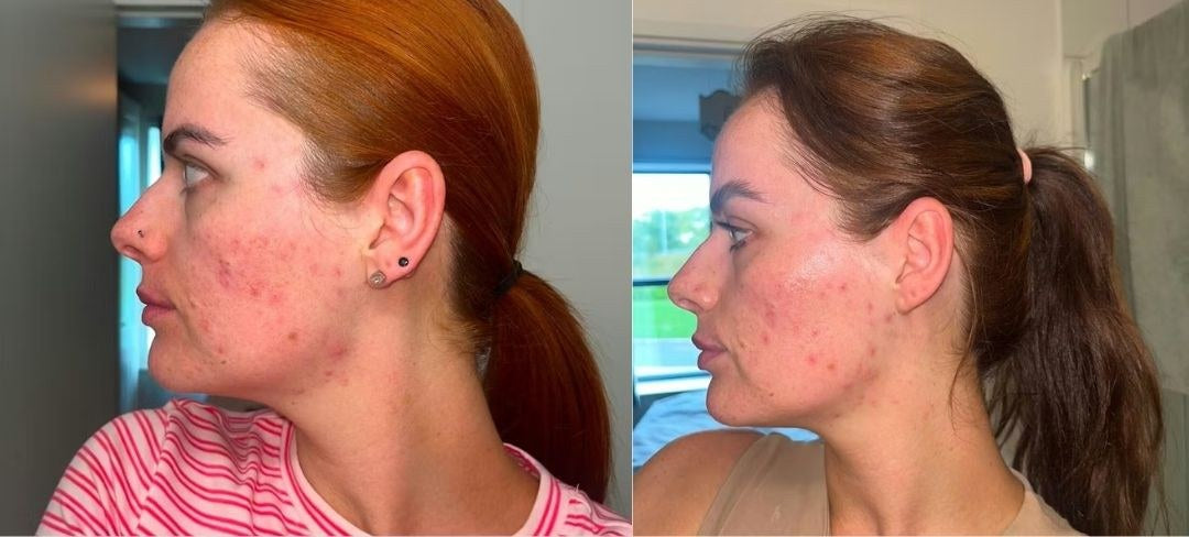 Antes y después · Jessica O.